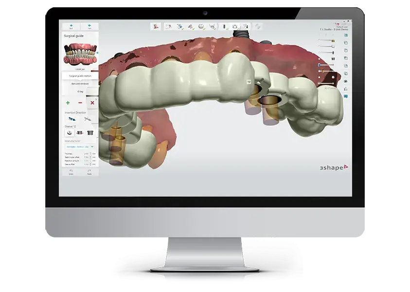 サージカルガイドの適用