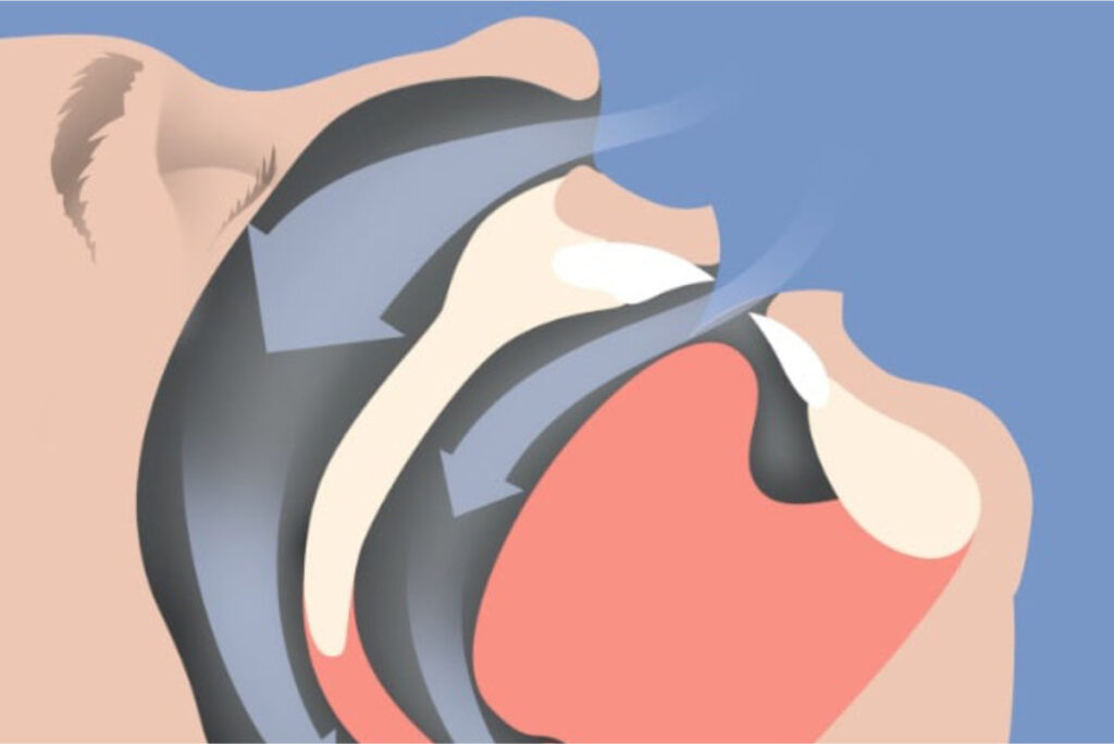 睡眠時の気道イラスト